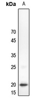 1 - Anti-C/EBP gamma Antibody AP60723