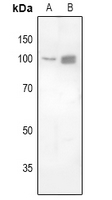 1 - Anti-FOXK1 Antibody AP60724