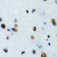 19 - Anti-TEF Antibody AP60725