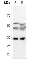 1 - Anti-TEF Antibody AP60725