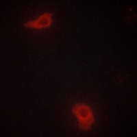 3 - Anti-DOK7 Antibody AP60726