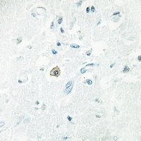 19 - Anti-DOK7 Antibody AP60726