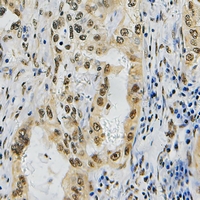 19 - Anti-ZNF436 Antibody AP60728