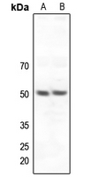 1 - Anti-ZNF436 Antibody AP60728