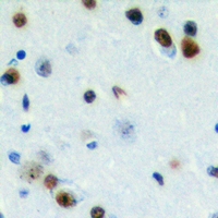19 - Anti-ZC3H7B Antibody AP60731