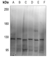1 - Anti-ZC3H7B Antibody AP60731