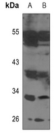 1 - Anti-TCFL5 Antibody AP60733