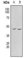 1 - Anti-CHKB Antibody AP60734