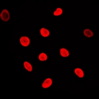 3 - Anti-Adenylate Kinase 6 Antibody AP60736