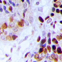 19 - Anti-Adenylate Kinase 6 Antibody AP60736
