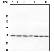 1 - Anti-Adenylate Kinase 6 Antibody AP60736