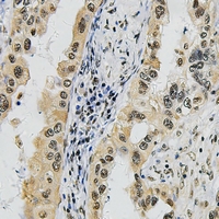 19 - Anti-SUPT16H Antibody AP60737