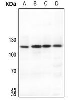 1 - Anti-SUPT16H Antibody AP60737