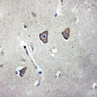 19 - Anti-5-HT2C Antibody AP60738