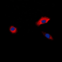 3 - Anti-Beta-1 Adrenergic Receptor Antibody AP60740