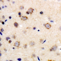 19 - Anti-Beta-1 Adrenergic Receptor Antibody AP60740