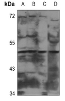 1 - Anti-CADM2 Antibody AP60741