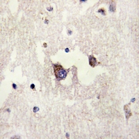 19 - Anti-CADM3 Antibody AP60742
