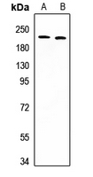 1 - Anti-DIDO1 Antibody AP60746