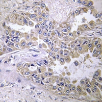 19 - Anti-Laminin beta 2 Antibody AP60747