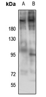 1 - Anti-Laminin beta 2 Antibody AP60747