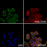3 - Anti-ACBD6 Antibody AP60748