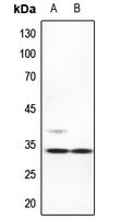1 - Anti-ACBD6 Antibody AP60748