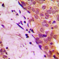 19 - Anti-APBB2 Antibody AP60749