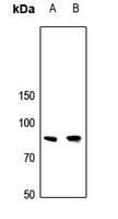 1 - Anti-APBB2 Antibody AP60749