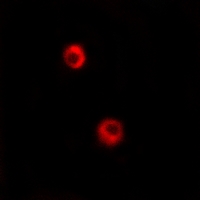 3 - Anti-Arylsulfatase I Antibody AP60751