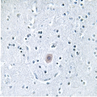19 - Anti-Arylsulfatase I Antibody AP60751