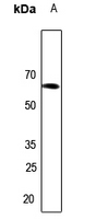 1 - Anti-Arylsulfatase I Antibody AP60751