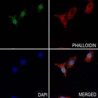3 - Anti-DDX19B Antibody AP60752