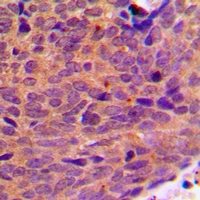 19 - Anti-DDX19B Antibody AP60752