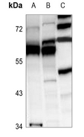 1 - Anti-DDX19B Antibody AP60752