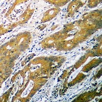 19 - Anti-B4GALT1 Antibody AP60753