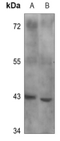 1 - Anti-B4GALT1 Antibody AP60753