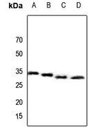 1 - Anti-CBR3 Antibody AP60754
