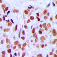 19 - Anti-RRP8 Antibody AP60756