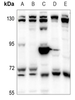 1 - Anti-Copine 8 Antibody AP60758