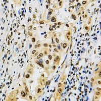 19 - Anti-POLR3B Antibody AP60759