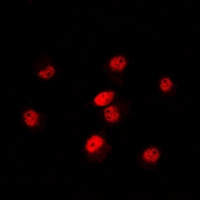 3 - Anti-POLR3E Antibody AP60760