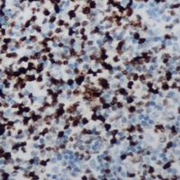 19 - Anti-CCNB1IP1 Antibody AP60761