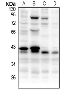 1 - Anti-CCNB1IP1 Antibody AP60761