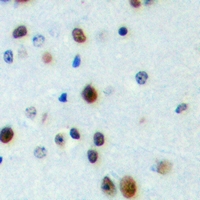 19 - Anti-FOXN4 Antibody AP60762