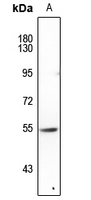 1 - Anti-FOXN4 Antibody AP60762
