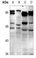 1 - Anti-GABRD Antibody AP60763
