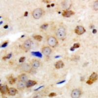 19 - Anti-GABRG1 Antibody AP60764