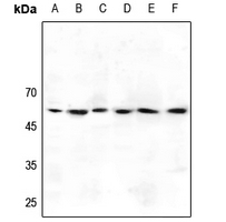 1 - Anti-GABRG1 Antibody AP60764