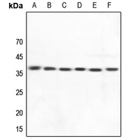 1 - Anti-HLA-DOA Antibody AP60766